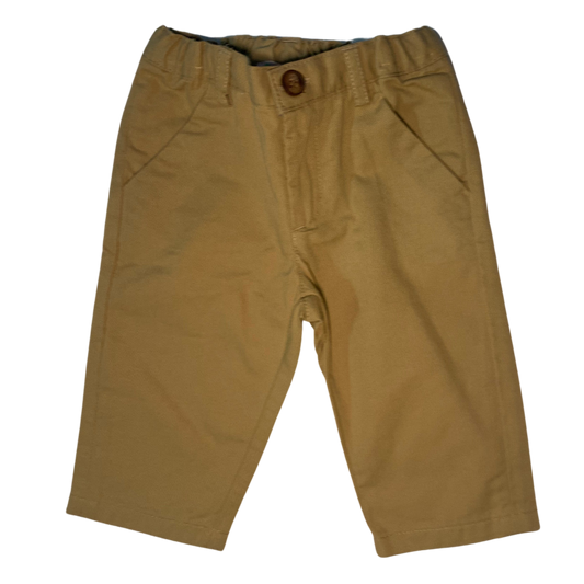 DECIBEL